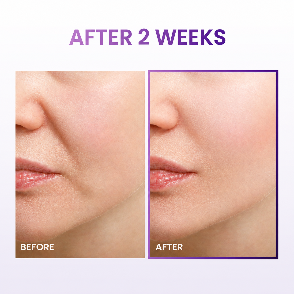 VEILOSM™ 3D Lifting Cream 1.69 fl oz Advanced Anti-Aging Probiotics Facial Night Cream with 17-Peptide Complex for Face & Neck Wrinkles