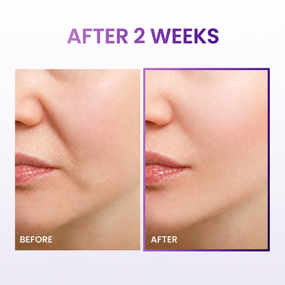 VEILOSM™ 3D Lifting Cream 1.69 fl oz Advanced Anti-Aging Probiotics Facial Night Cream with 17-Peptide Complex for Face & Neck Wrinkles