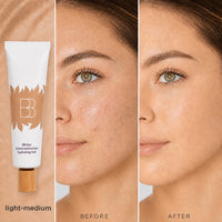 Light-medium