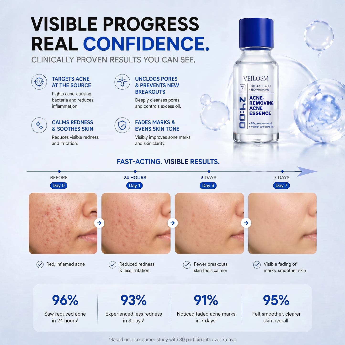 VEILOSM 4-in-1 Bio-Active Protocol: Anti-Acne, Calming, Mark-Fading & Oil-Control